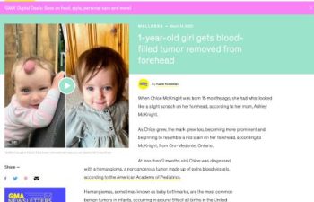 Screenshot of an article titled: 1-year-old girl gets blood-filled tumor removed from forehead