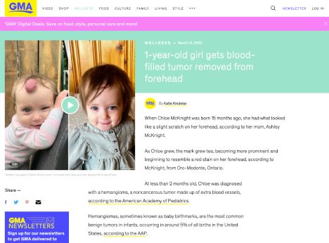 Screenshot of an article titled: 1-year-old girl gets blood-filled tumor removed from forehead